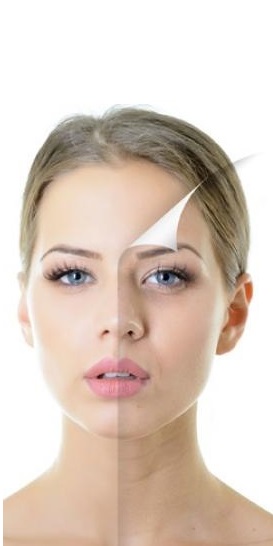 Chemical Peels services in Calgary